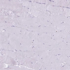 Immunohistochemical staining of human skeletal muscle shows no positivity in myocytes as expected.