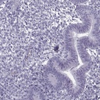 Anti-GTSF1L Antibody