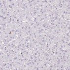 Immunohistochemical staining of human liver shows no positivity in hepatocytes as expected.