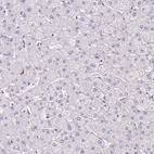 Immunohistochemical staining of human liver shows no positivity in hepatocytes as expected.