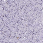 Immunohistochemical staining of human pancreas shows low expression as expected.