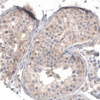 Immunohistochemical staining of human testis shows weak membranous and cytoplasmic positivity in cells in seminiferous ducts.