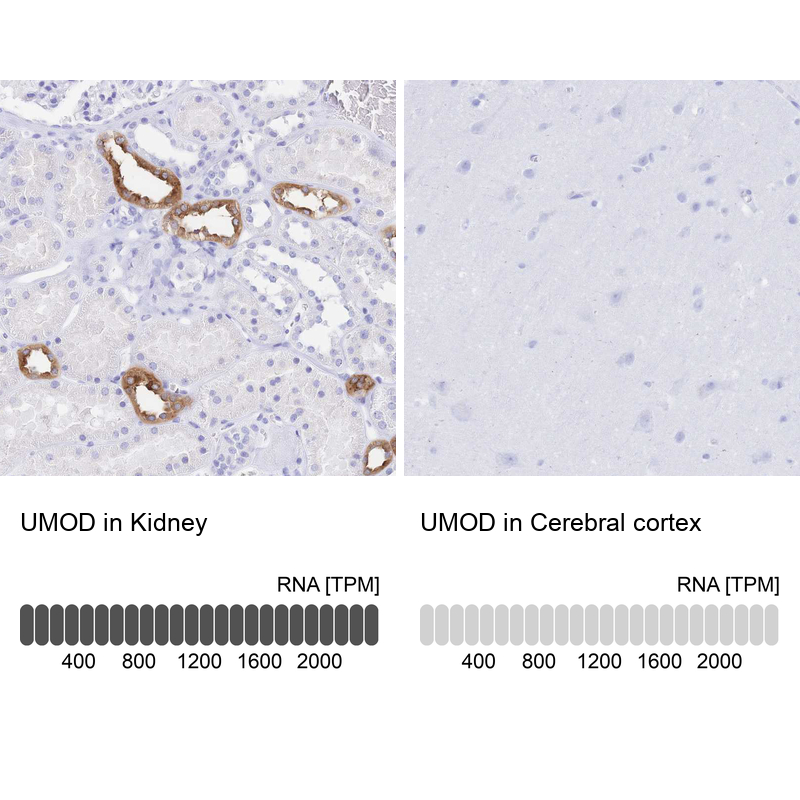Anti-UMOD Antibody
