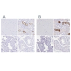 Immunohistochemical staining of human cerebral cortex, kidney, placenta and testis using Anti-UMOD antibody HPA054721 (A) shows similar protein distribution across tissues to independent antibody HPA043420 (B).