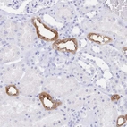 Immunohistochemical staining of human kidney shows moderate cytoplasmic positivity in cells in tubules.