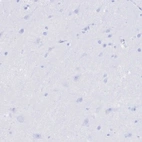 Immunohistochemical staining of human cerebral cortex shows no positivity in neurons as expected.