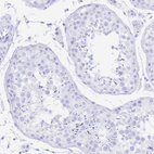 Immunohistochemical staining of human testis shows no positivity in cells in seminiferous ducts as expected.
