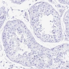 Immunohistochemical staining of human testis shows no positivity in cells in seminiferous ducts as expected.