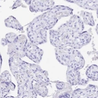 Immunohistochemical staining of human placenta shows no positivity in trophoblastic cells as expected.