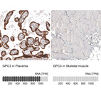 Anti-GPC3 Antibody