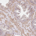 Anti-SULF1 Antibody
