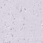 Immunohistochemical staining of human cerebral cortex shows no positivity in neurons as expected.