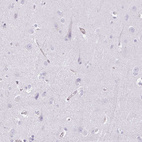 Anti-SULF1 Antibody