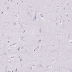 Immunohistochemical staining of human cerebral cortex shows no positivity in neurons as expected.