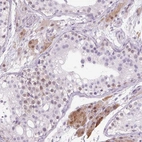 Anti-ZNF35 Antibody