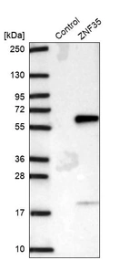Western blot analysis in control (vector only transfected HEK293T lysate) and ZNF35 over-expression lysate (Co-expressed with a C-terminal myc-DDK tag (~3.1 kDa) in mammalian HEK293T cells, LY418712).