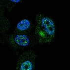 Immunofluorescent staining of human cell line PC-3 shows localization to nucleoplasm & cytosol.