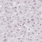 Immunohistochemical staining of human liver using Anti-TMEM237 antibody HPA054732.