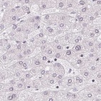 Anti-TMEM237 Antibody