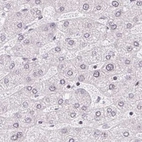 Immunohistochemical staining of human liver using Anti-TMEM237 antibody HPA054732.