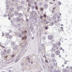 Immunohistochemical staining of human testis using Anti-TMEM237 antibody HPA054732.