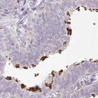 Immunohistochemical staining of human fallopian tube using Anti-TMEM237 antibody HPA054732.