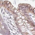 Immunohistochemical staining of human colon using Anti-TMEM237 antibody HPA054732.