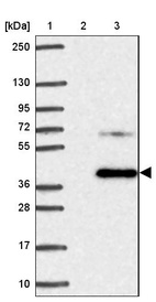Lane 1: Marker [kDa] 250, 130, 95, 72, 55, 36, 28, 17, 10_br/_Lane 2: Human cell line RT-4_br/_Lane 3: Human cell line U-251MG sp