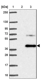 Lane 1: Marker [kDa] 250, 130, 95, 72, 55, 36, 28, 17, 10_br/_Lane 2: Human cell line RT-4_br/_Lane 3: Human cell line U-251MG sp