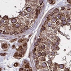 Immunohistochemical staining of human testis using Anti-NFS1 antibody HPA054755.