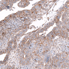 Anti-GPC3 Antibody