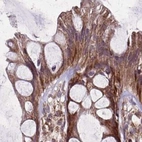 Immunohistochemical staining of human colon using Anti-NFS1 antibody HPA054755.