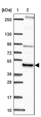 Lane 1: Marker [kDa] 250, 130, 95, 72, 55, 36, 28, 17, 10_br/_Lane 2: Human cell line RT-4