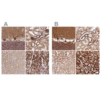 Anti-MT-CO2 Antibody
