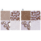 Immunohistochemical staining of human cerebral cortex, colon, prostate and skeletal muscle using Anti-BCAS1 antibody HPA054745 (A) shows similar protein distribution across tissues to independent antibody HPA051816 (B).
