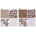 Immunohistochemical staining of human cerebral cortex, colon, prostate and skeletal muscle using Anti-BCAS1 antibody HPA054745 (A) shows similar protein distribution across tissues to independent antibody HPA051816 (B).