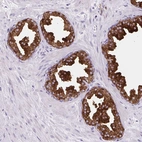 Immunohistochemical staining of human prostate shows strong cytoplasmic positivity in glandular cells.
