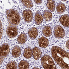 Immunohistochemical staining of human colon shows strong cytoplasmic positivity in glandular cells.