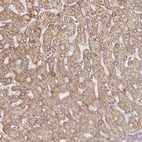 Immunohistochemical staining of human liver shows moderate granular cytoplasmic positivity in hepatocytes.