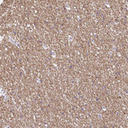 Immunohistochemical staining of human cerebral cortex shows moderate cytoplasmic positivity in neuropil.