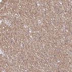 Immunohistochemical staining of human cerebral cortex shows moderate cytoplasmic positivity in neuropil.