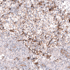 Anti-GPC3 Antibody