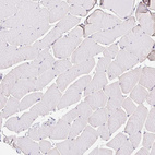 Immunohistochemical staining of human skeletal muscle shows no positivity in myocytes as expected.
