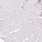 Immunohistochemical staining of human skeletal muscle shows no positivity in myocytes as expected.