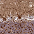 Immunohistochemical staining of human cerebellum shows strong granular cytoplasmic positivity in Purkinje cells.