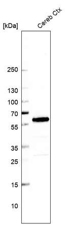 Western blot analysis in human cerebral cortex tissue.