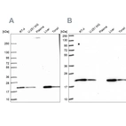 Western blot analysis using Anti-MT-CO2 antibody HPA054758 (A) shows similar pattern to independent antibody HPA051505 (B).