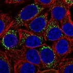 Immunofluorescent staining of human cell line MCF7 shows localization to vesicles.