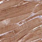 Anti-FAM65C Antibody