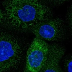 Anti-TMCO1 Antibody